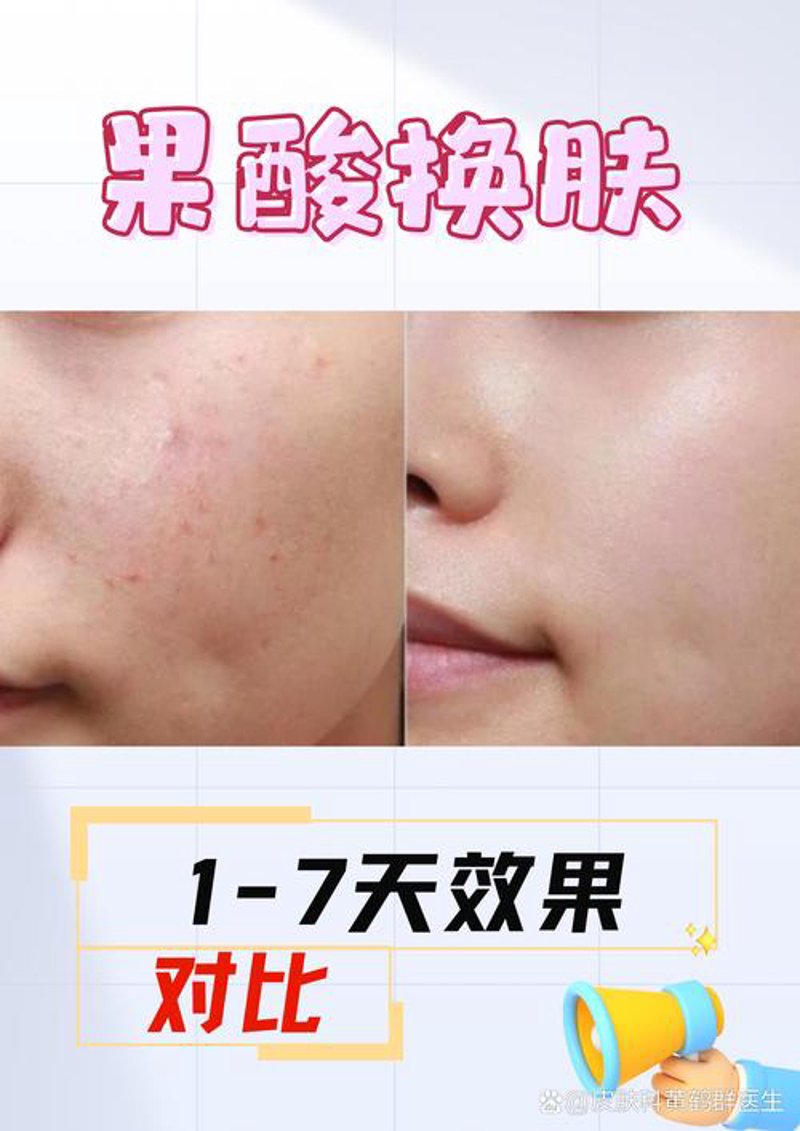 敏感肌修复：从日常防护到专业治疗